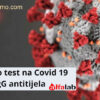 Alfalab Laboratorije: Test na Covid-19 (serološki test)